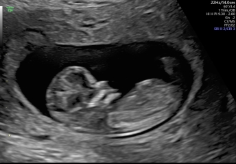 Any gender guesses.