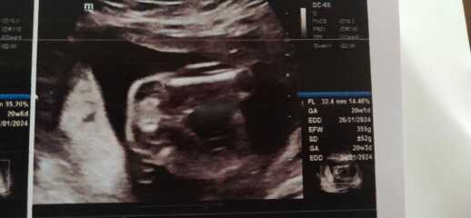 Can you guys help me find my baby gender?
