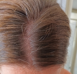 Can someone help me with my hair (dye) FML