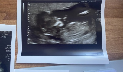 Baby gender