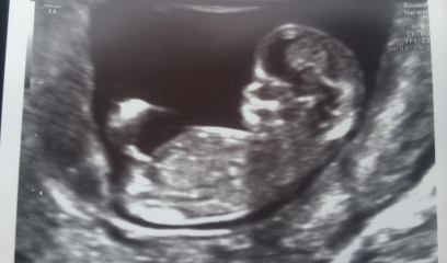 Siblings Scan Identical - same gender?!
