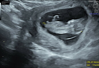 March 2024 continued!