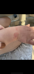 Sons friend biting - advice please!