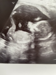 Gender guesses?