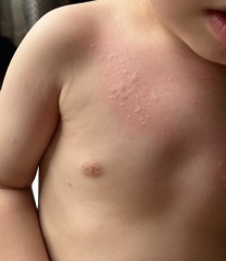 Help! What does this rash look like?!