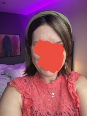 Hair loss - where now?
