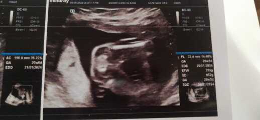Can you guys help me find my baby gender?