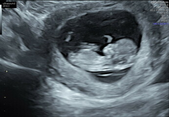March 2024 continued!