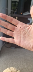 Could this be Melanoma?