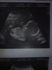 Boy or girl?