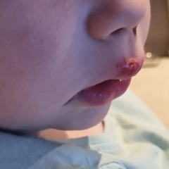 3 year old fall