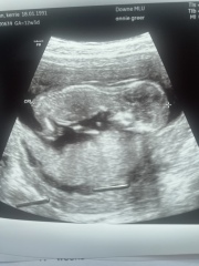 March 2024 continued!