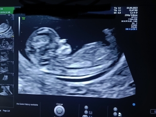 Any gender guesses?