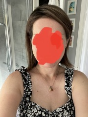 Hair loss - where now?