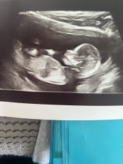 Baby Gender?!