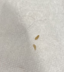 What is this?! (Warning) Picture included