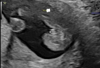 Boy or girl?