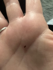 Bedbugs