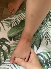 Help! What does this rash look like?!