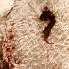 Thing I pulled out from my nose