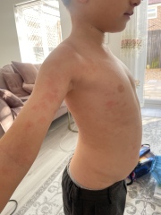 To think my child should be allergy tested ?  Pics