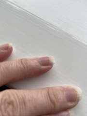 Nail ridge