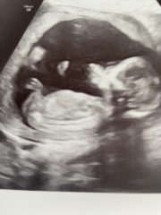 Gender guesses?