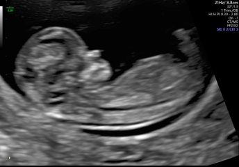 Any gender guesses.