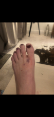 Panicking!! Dodgy mole?