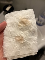 Implantation bleeding?