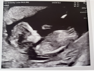 Boy or girl?