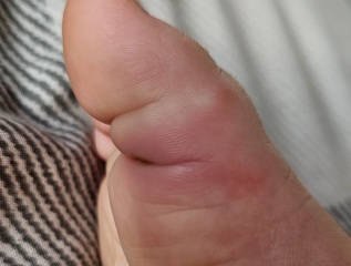 Pharmacist/GP or just over anxious mum? pic attached