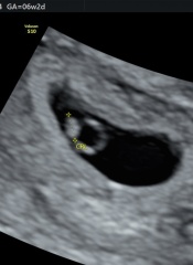 Due May 2024?