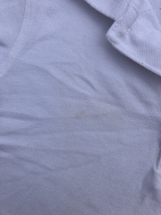 Stain remover for white clothes?