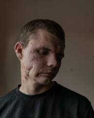 Ukraine Invasion: Part 44