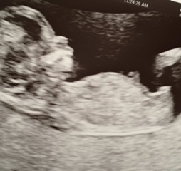 Has anyone had nub theory be wrong?