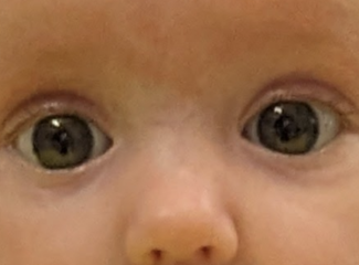 Does my baby have a (very) minor squint?