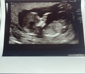 Baby gender