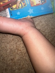 Strange rash…