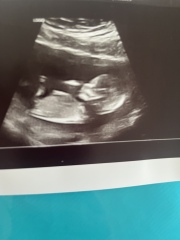 Baby Gender?!