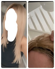 Hair Mesh System