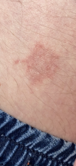 Skin thing