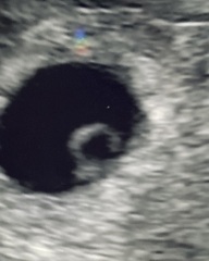 Do you see 1 or 2 babies?