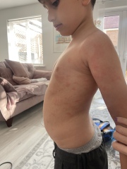 To think my child should be allergy tested ?  Pics