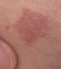 Skin thing