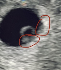 Do you see 1 or 2 babies?