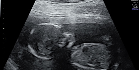 Humour me..sex scan :)