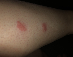 What are these