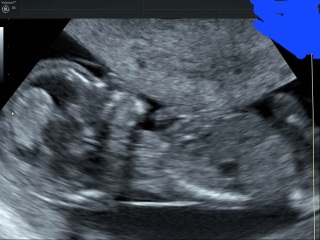 Boy or girl?