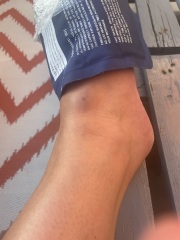 Should I go to minor injuries (photo)
